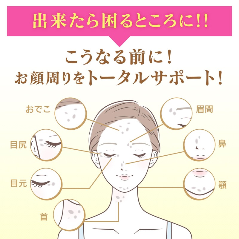 [ ケシミン ] ケシミン浸透化粧水 さっぱりすべすべ 本体【 ビタミンC 誘導体と VホワイトC 配合】【