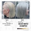 3 Shampoo Black Matiz Jehesmipa Original