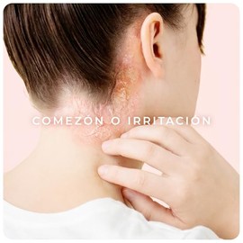 Derman PS Calm Emulsión Corporal │ Urea-D 10% + Ácido Salicílico │ 400 mL