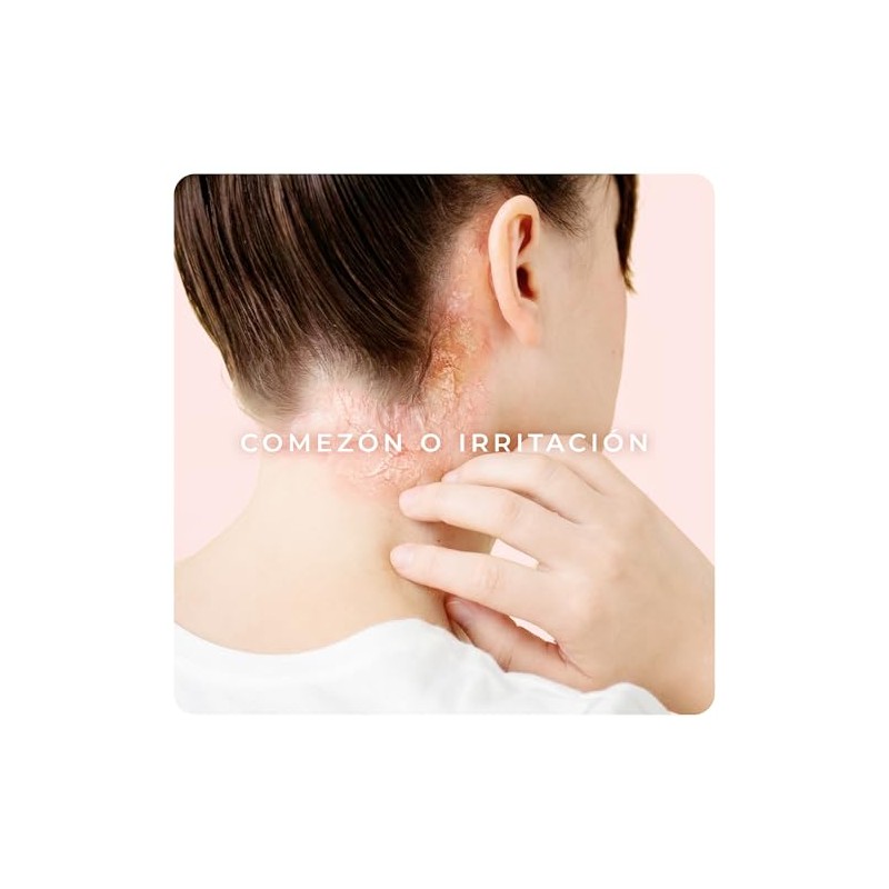 Derman PS Calm Emulsión Corporal │ Urea-D 10% + Ácido
