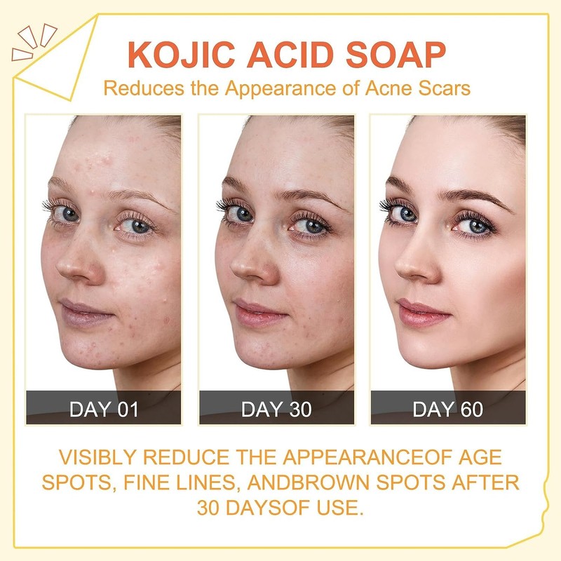 2 x 65G Peak Light Kojic Acid Skin Lightning Soap