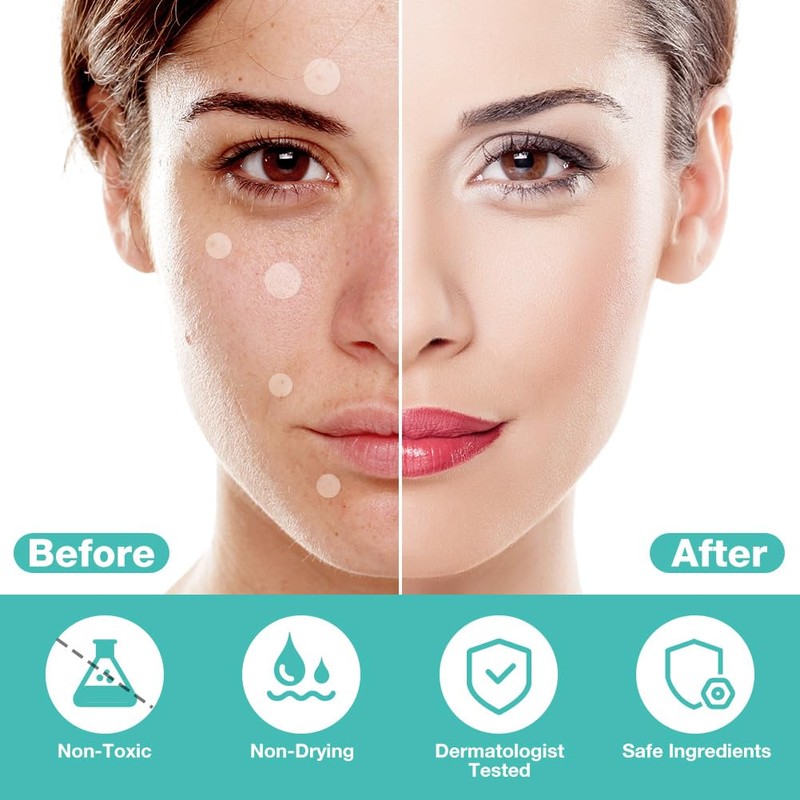 BUTBU 360 Pieces Round Pimple Patch, Hydrocolloid Pimple Patch Invisible,