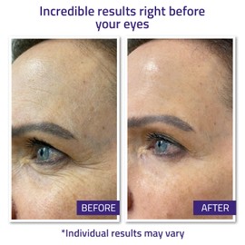 YEOUTH Instant Face Lift Cream, Temporary Skin Tightening Under Eye Cream for Women, Tightening and Lifting Concealer 15ml