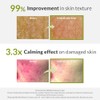 ZEROID Intensive Cream Korean Dermocosmetic Intensive Care for Severe Dry