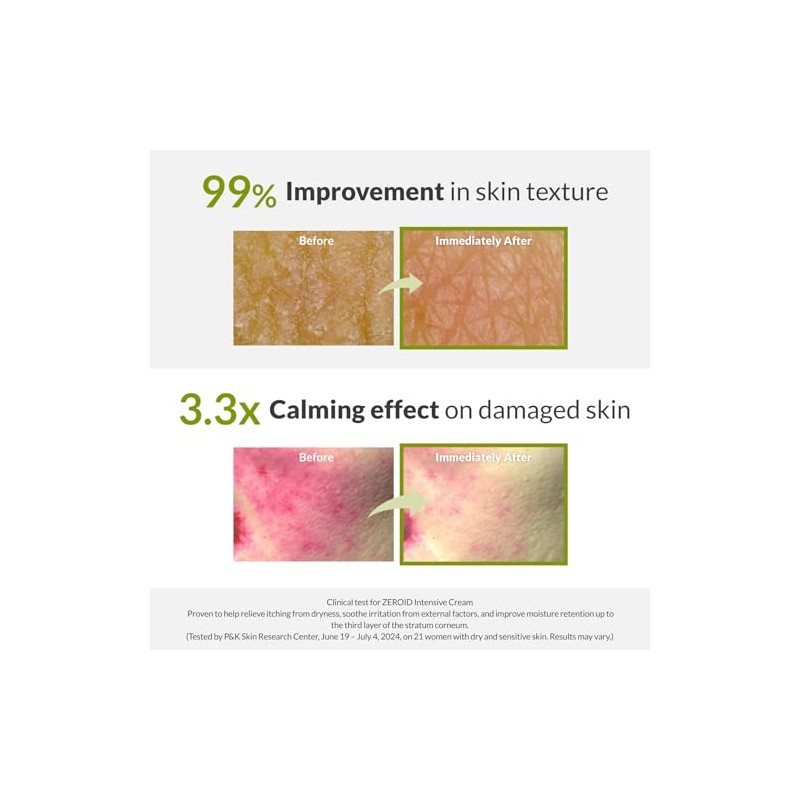 ZEROID Intensive Cream Korean Dermocosmetic Intensive Care for Severe Dry