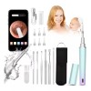 Suweazc Herramienta Con Cámara 1080p P/limpieza De Oído, 7 Piezas