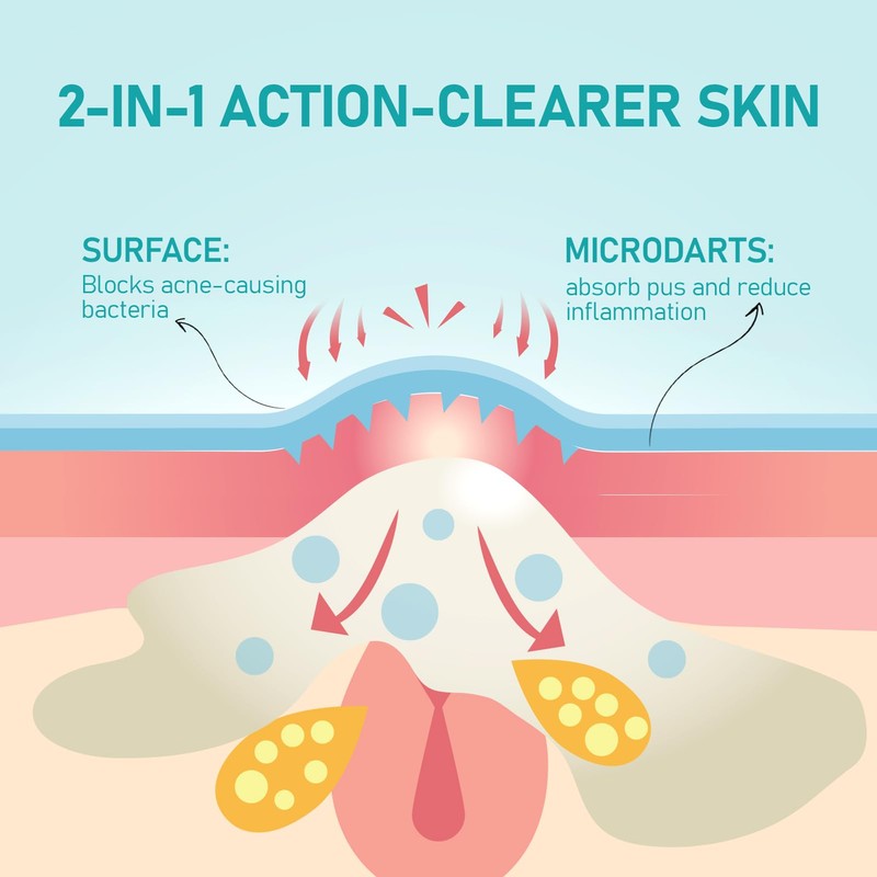 ANGTICS Pimple Patches Microdart, Zit Patches with Microdart Technology
