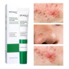 Crema Limpiadora Facial Anti Acné Y Cicatrices