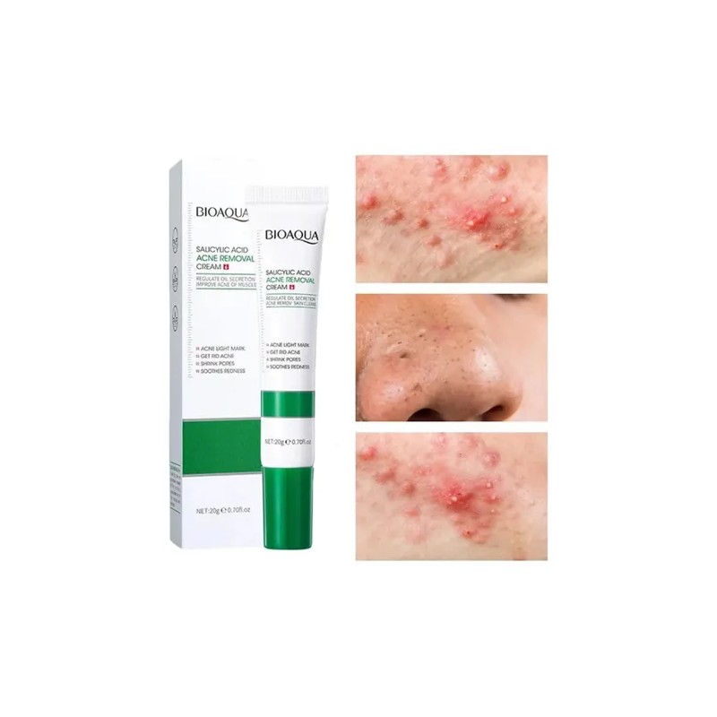Crema Limpiadora Facial Anti Acné Y Cicatrices
