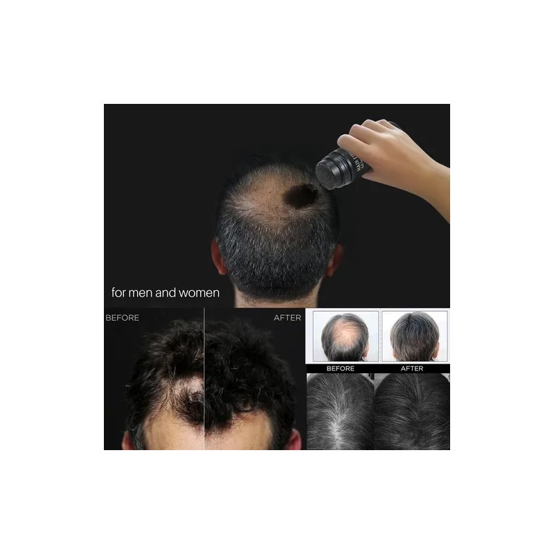 Polvo De Fibra Capilar Negro Cubre Raz De Cabello Calvicie