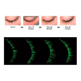 Loclem Serum Para Crecimiento Y Fortalecimiento De Pestañas