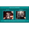 Solución Anticaida Para Mujer Con Cabello Con Caspa