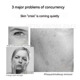 „ÄêQINGLIN„ÄëFace cream/polypeptide firming full face cream