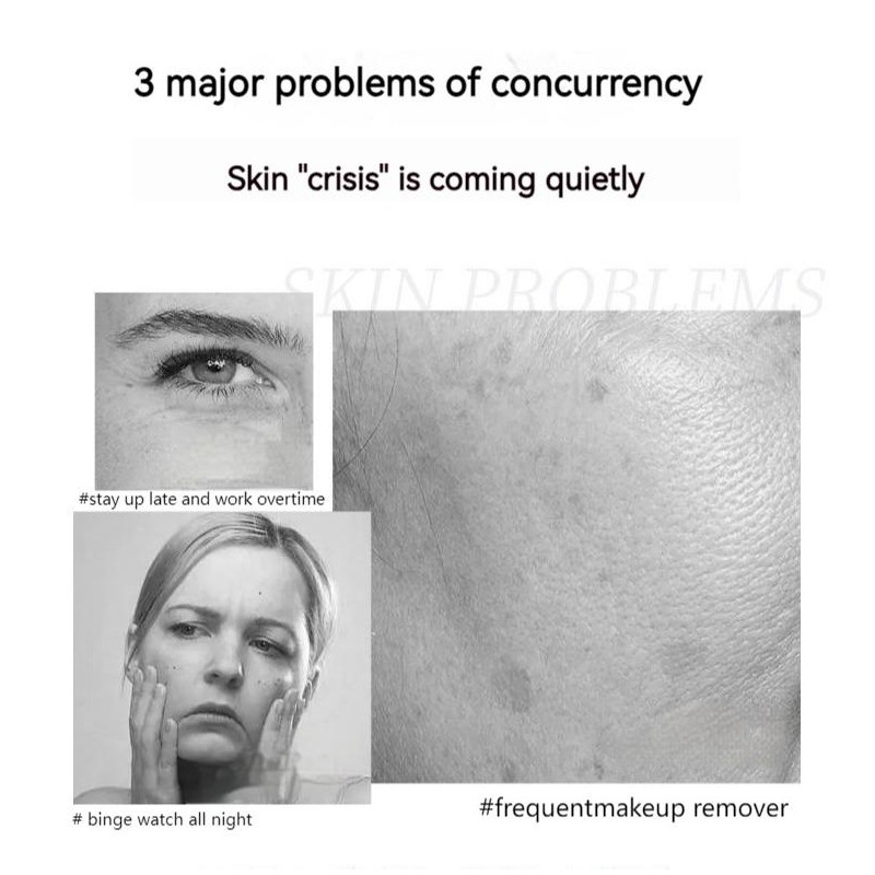 „ÄêQINGLIN„ÄëFace cream/polypeptide firming full face cream