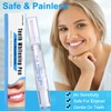 Teeth Whitening Pen - Painless Whitener with No Sensitivity, 1