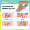 TEVEZO Toe Spacers & Bunion Corrector for Kids | Toe