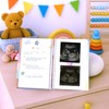 VIMAD® Pregnancy Journal, Pregnancy Book, Original Pregnancy Album, Baby Album,