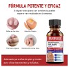 Fungicida Para Uñas Eliminar Hongos En Uñas De Manos Y