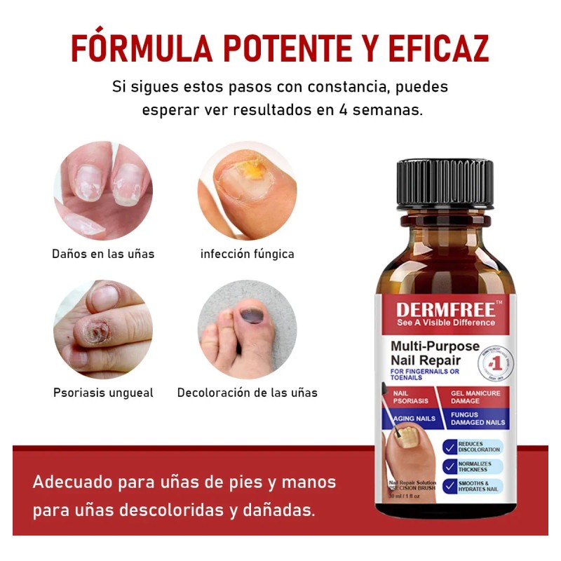 Fungicida Para Uñas Eliminar Hongos En Uñas De Manos Y