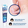 Crema Removedora De Verrugas Rápida Y Fácil, Pomada, 20 G