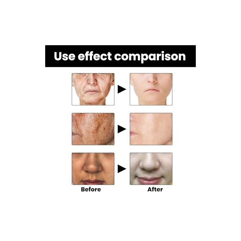 Sérum Facial Generic