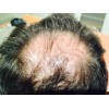 Shampoo Seber Sabila 500ml