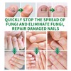 JAYSUING Ginger Nail Treatment-Vitamin E & Plant Extracts for Repairing