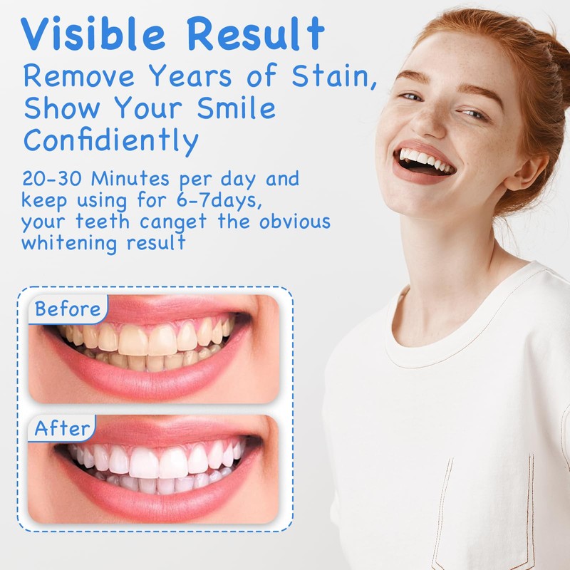 Bettinay 2 Pcs Gum Repair Gel, 30 Ml Gum Shield