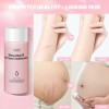 Vgo Women Skin Care Body Oil Eliminación De Cicatrices Adecu