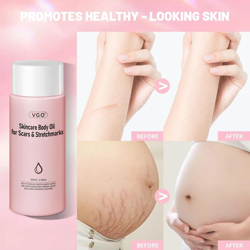 Vgo Women Skin Care Body Oil Eliminación De Cicatrices Adecu