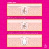 Crema Mágica Quita Puntos Negros Lanbena Tiras Mixta