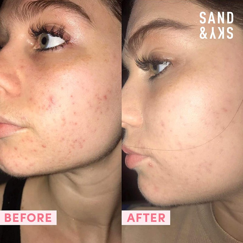 Sand & Sky Australian Pink Clay Porefining Face Mask Skin