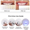 GlorySmile Teeth Whitening Kit with LED Light, 10-Min Fast Whitener,