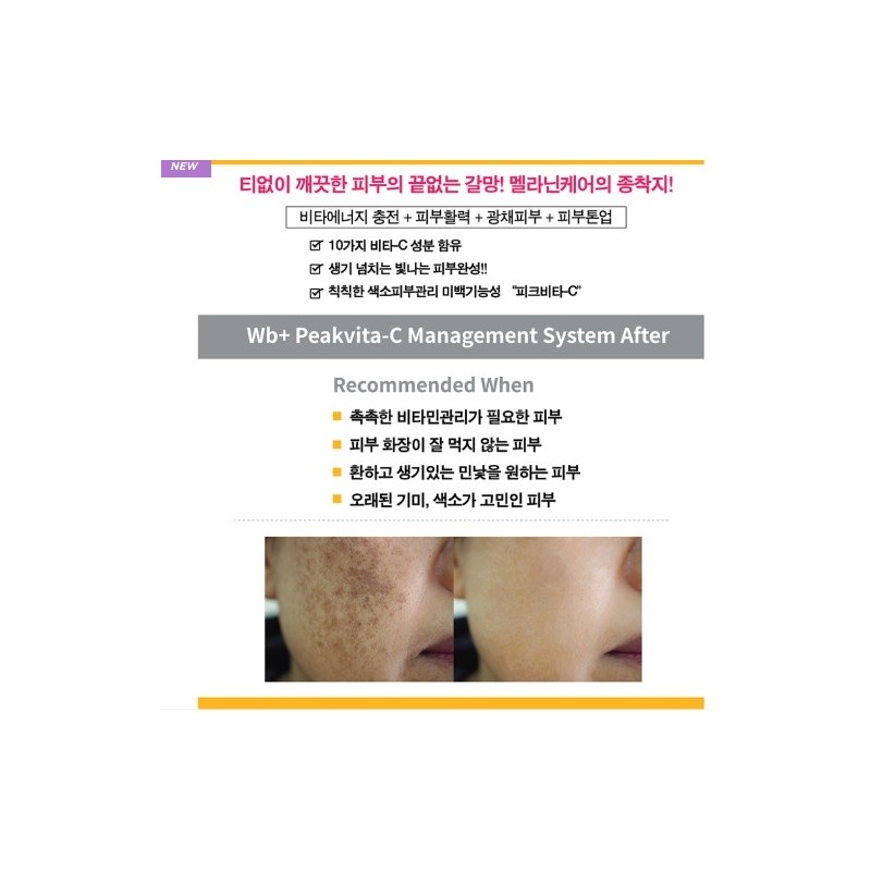 Hillen Aesthetic Whitening Blemish Removal Whitening Vitamin Cream 30ml /