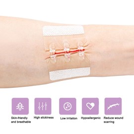 Longmed Emergency Wound Closure Strips Butterfly Bandages Stitch Sutures Adhesive Bandages for First Aid Zipper Laceration Repair Without Stitches for Wound Care (S)