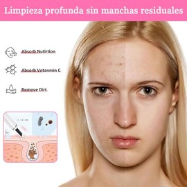 Limpiador Facial Ultrasónico con Pantalla Led, Espatula Ultrasonica Facial con 4 Modos, Consigue Una Limpieza y Profunda Del Acné y Los Puntos Negros,