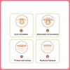 42pcs Pimple Healing Patches Reduce Swelling Diminish Blemishes Heart Shaped