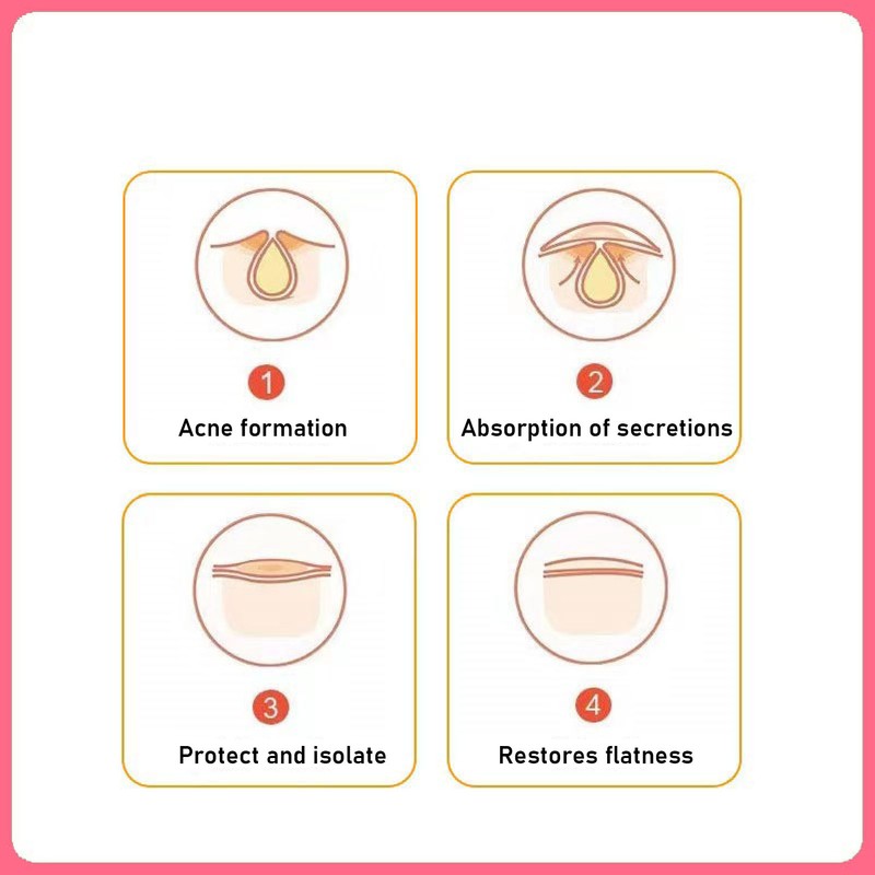 42pcs Pimple Healing Patches Reduce Swelling Diminish Blemishes Heart Shaped