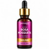 Aceite Rosa Mosqueta Puro Perennis Facial Hidratante Regenerador Piel Estrías
