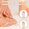 14 Pcs Toe Straighteners for Bent Toes, Hammer Toe Straightener