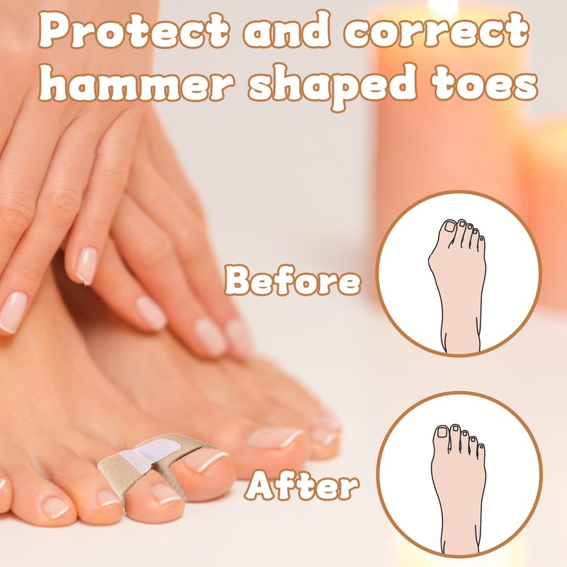 14 Pcs Toe Straighteners for Bent Toes, Hammer Toe Straightener