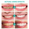 Foam Toothpaste 2PCS,Stain Removal Toothpaste for Sensitive Teeth,Teeth foaming Whitening,Baking