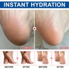2 pieces urea cream, 60% urea cream, 60% foot care