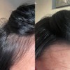 Anti Hair Loss Shampoo Tricostrong 200ml - With Tricofactor Growth