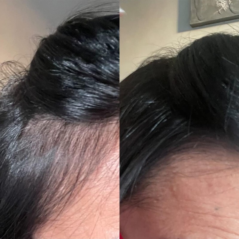 Anti Hair Loss Shampoo Tricostrong 200ml - With Tricofactor Growth