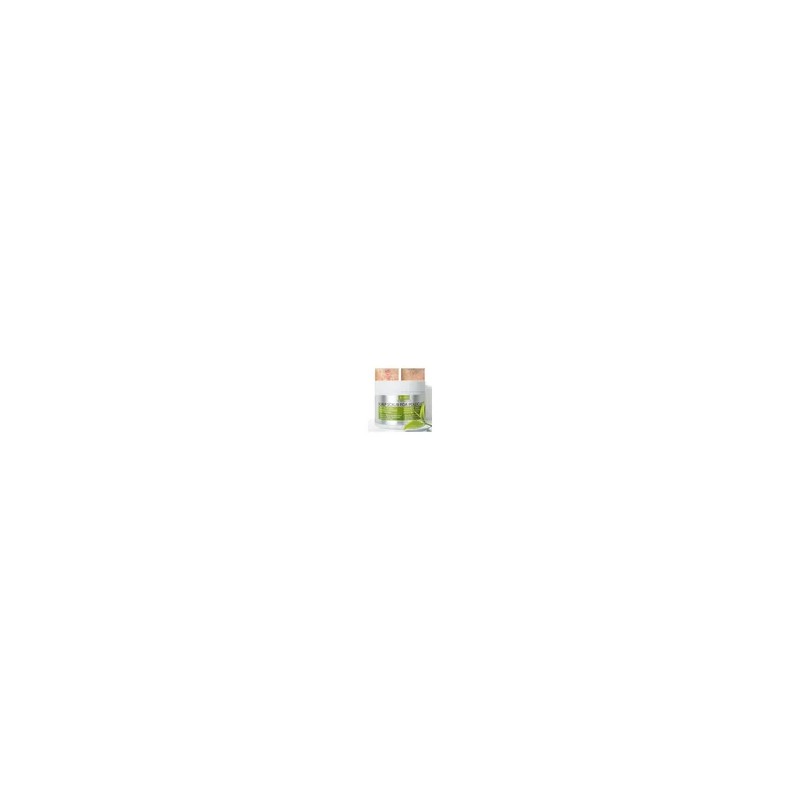 Exfoliante Antifúngico Cuero Cabelludo Sensible 230 Ml
