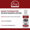 BREEJ Bump Terminator Severe Bumps Lotion (4oz)