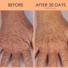 Crépe Erase is an advanced anti-aging hand treatment designed to