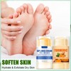 2Pcs Fußcreme Stick Set - Hydrating Urea Creme 60 Prozent