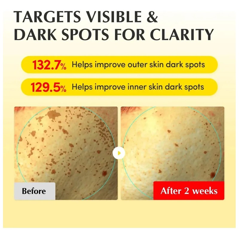 Fc Crema Iluminadora Con Vitaminas Equalberry Hidratación S